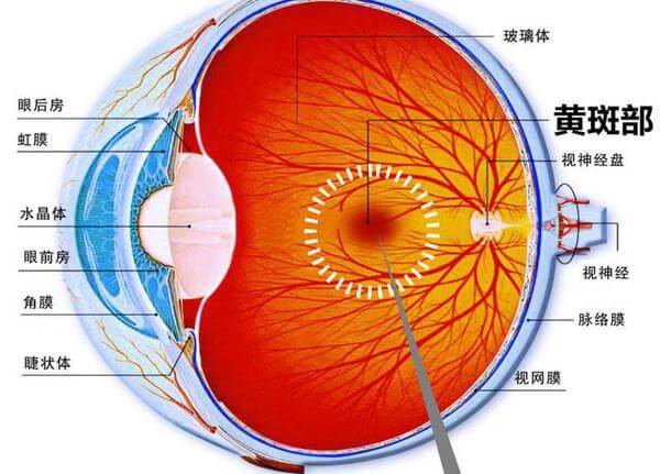 增龄性黄斑变性